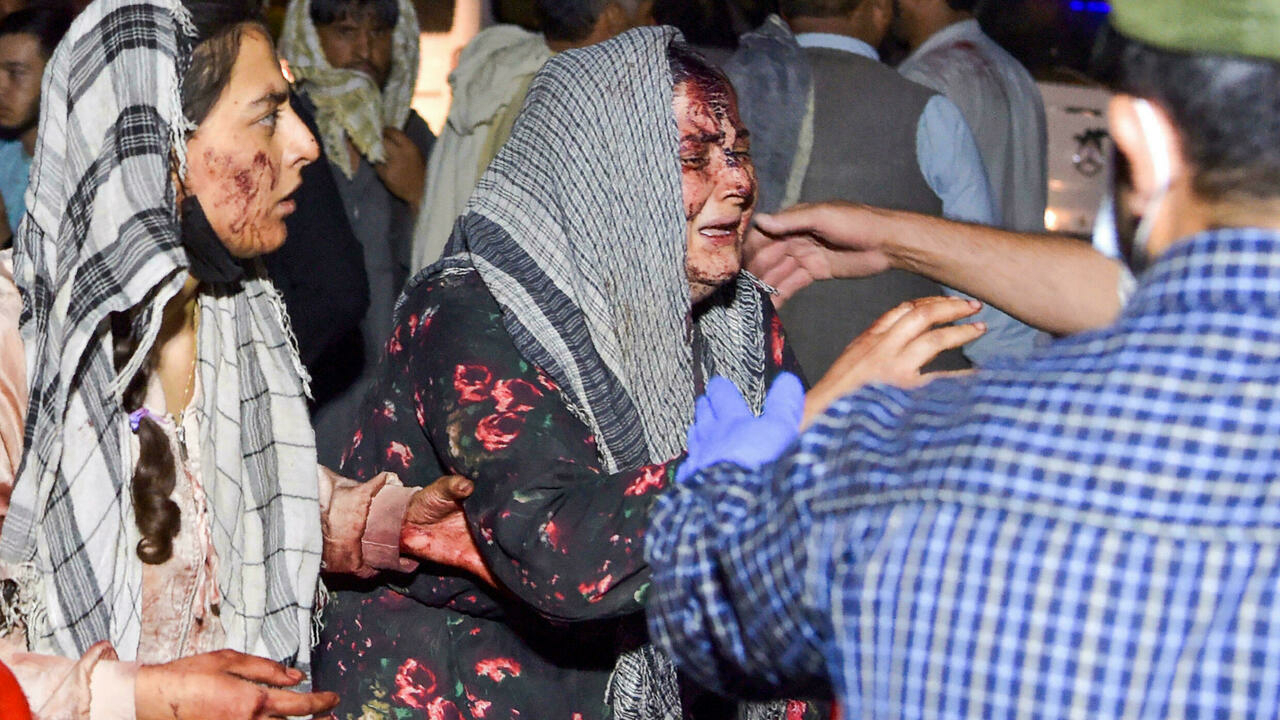 Wounded Afghans at the Kabul airport